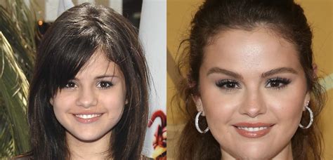 selena gomez boobs before and after|Selena Gomez shows off different faces after。